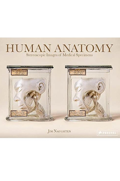 Human Anatomy : Stereoscopic Images of Medical Specimens